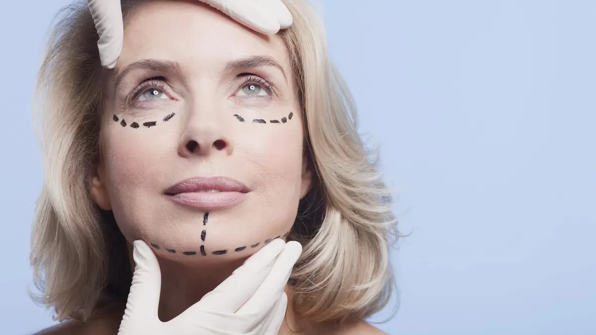 facelift recovery tips