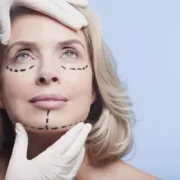 facelift recovery tips