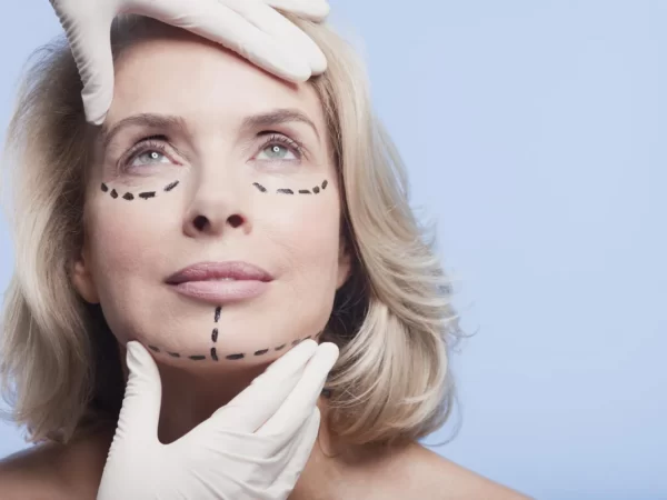 facelift recovery tips