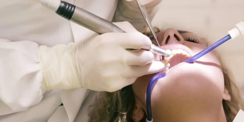 dental implant longevity